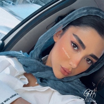 rhinoplasty-35