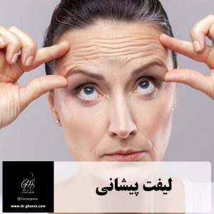 لیفت پیشانی - dr-ghanei.com