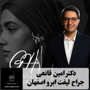 بهترین جراح لیفت ابرو اصفهان