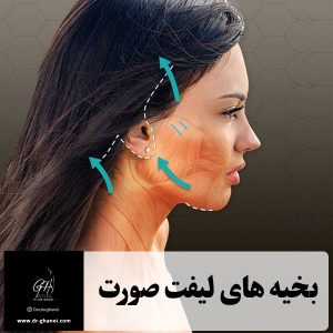 بخیه های لیفت صورت