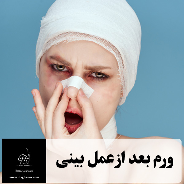 ورم بعد از عمل بینی