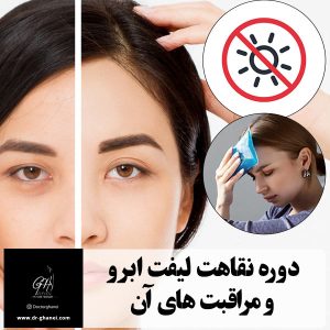 مراقبت های بعد از جراحی لیفت ابرو - دکتر قانعی