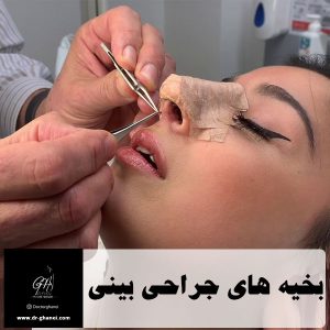 بخیه های جراحی بینی
