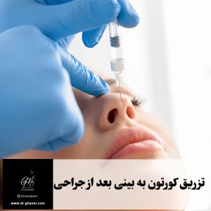 تزریق کورتون بعد از جراحی بینی