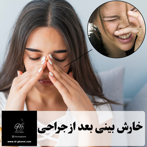 خارش بینی بعد از جراحی