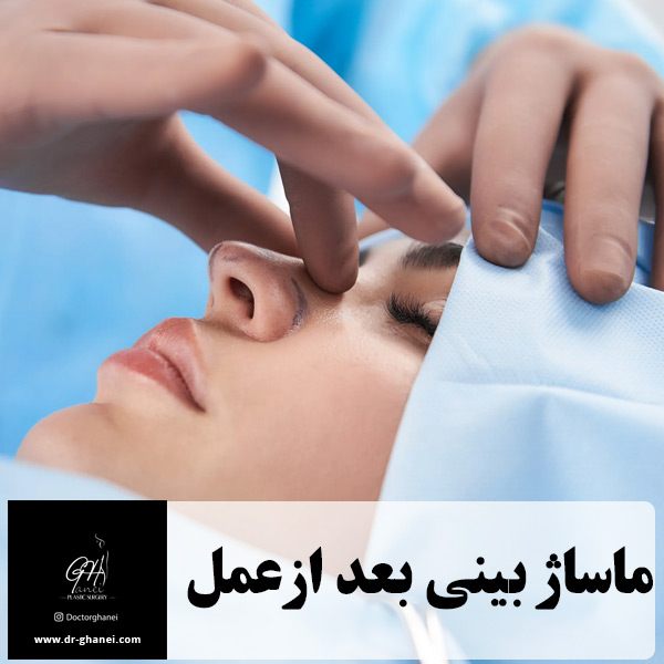 ماساژ بینی بعد از عمل