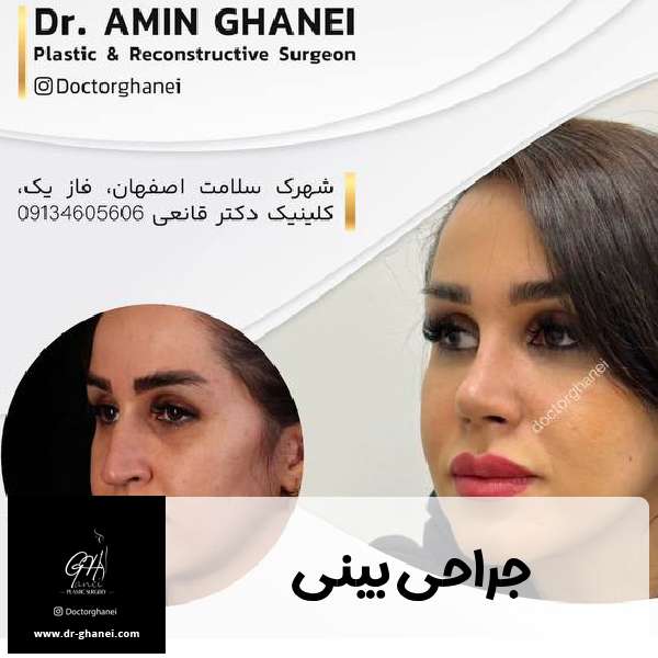 عکس جراحی بینی