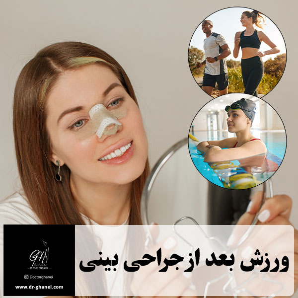 ورزش بعد از جراحی بینی