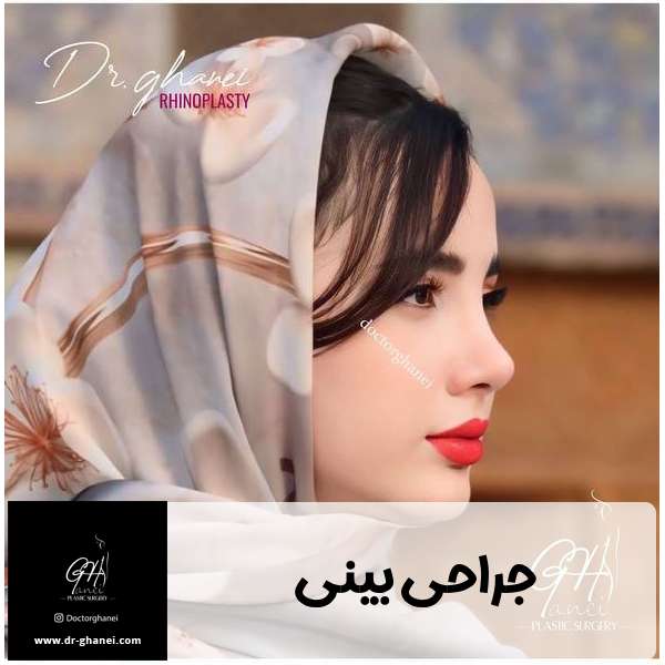 عکس بینی عمل شده