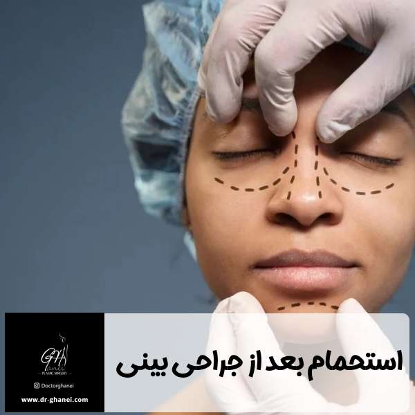 استحمام بعد از جراحی بینی