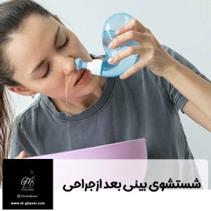 شستشوی بینی بعد از عمل - دکتر امین قانعی
