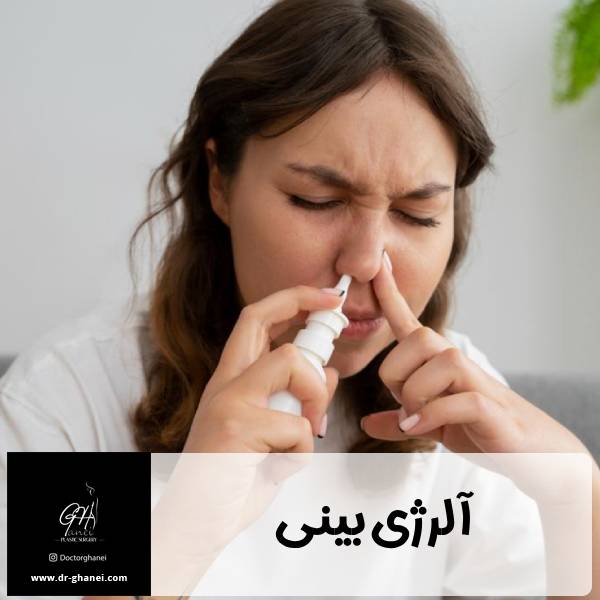 آلرژی بینی