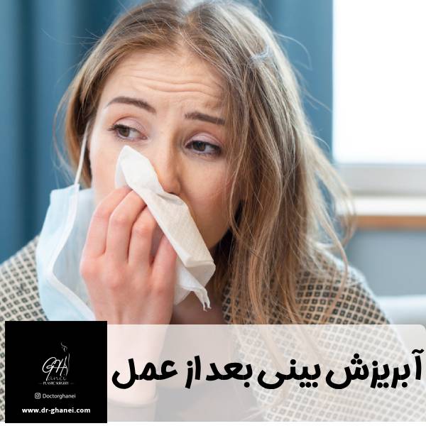 آبریزش بینی بعد از عمل - دکتر امین قانعی