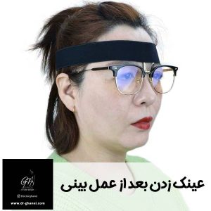 عینک زدن بعد از عمل بینی