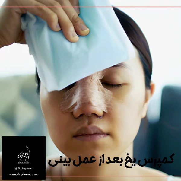 کمپرس یخ بعد از عمل بینی - دکتر قانعی 