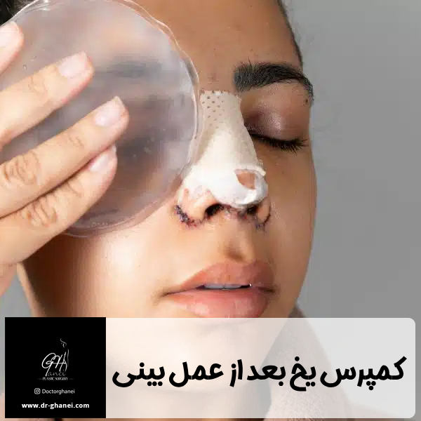 کمپرس یخ بعد از عمل بینی - دکتر قانعی