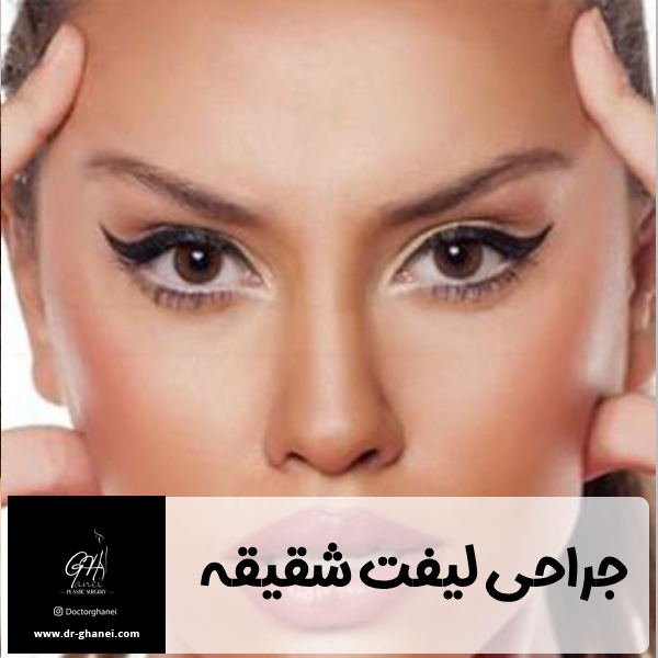 جراحی لیفت شقیقه - دکتر امین قانعی