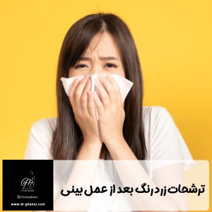 ترشحات زرد رنگ بعد از عمل بینی - دکتر امین قانعی