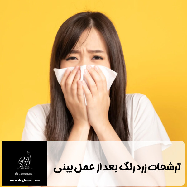 ترشحات زرد رنگ بعد از عمل بینی - دکتر امین قانعی