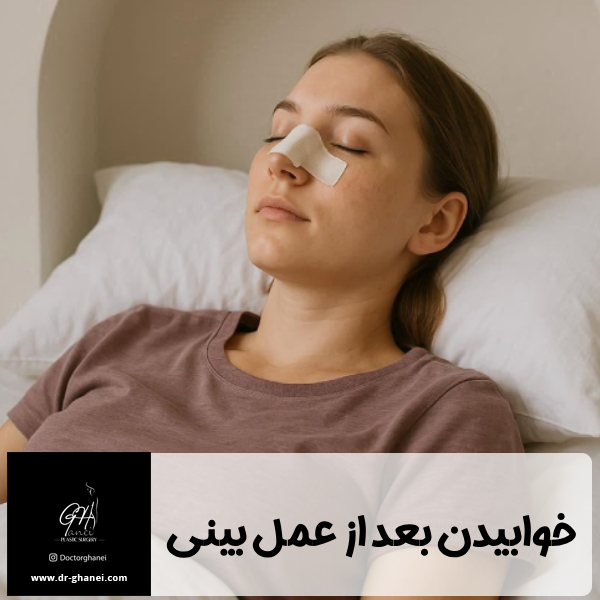 خوابیدن بعد از عمل بینی - دکتر امین قانعی