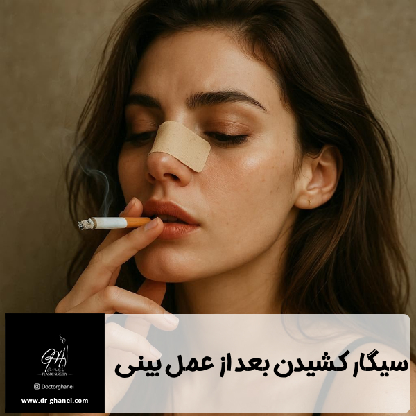 سیگار کشیدن بعد از عمل بینی - دکتر امین قانعی