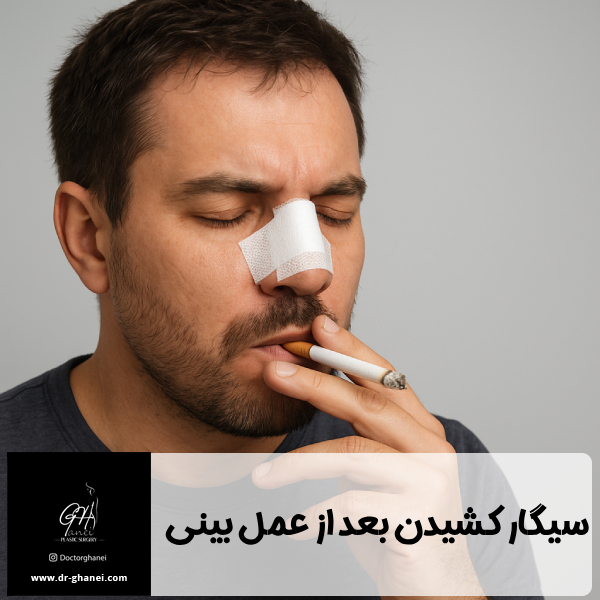 سیگار کشیدن بعد از عمل بینی - دکتر امین قانعی 