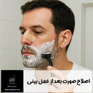 اصلاح صورت بعد از عمل بینی - دکتر امین قانعی