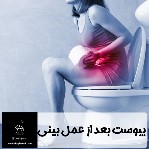 یبوست بعد از عمل بینی - دکتر امین قانعی