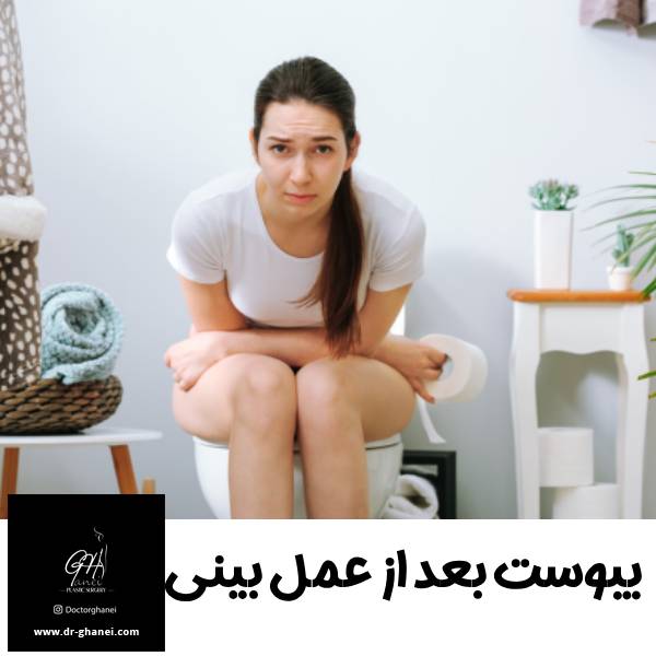 یبوست بعد از عمل بینی - دکتر امین قانعی