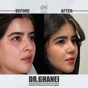 بهترین جراح بینی اصفهان - دکتر امین قانعی