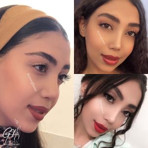 بهترین جراح بینی اصفهان - دکتر امین قانعی