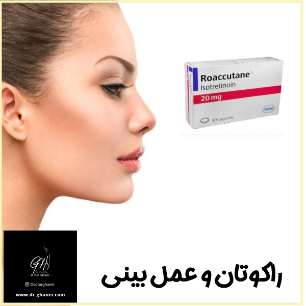 راکوتان و عمل بینی - دکتر امین قانعی