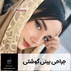 عمل بینی گوشتی - دکتر قانعی