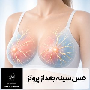 حس سینه بعد از پروتز - دکتر امین قانعی